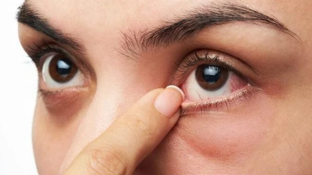 bai-viet/tinh-trung-ban-vao-mat-co-sao-khong-cach-xu-tri-khi-tinh-trung-ban-vao-mat.html