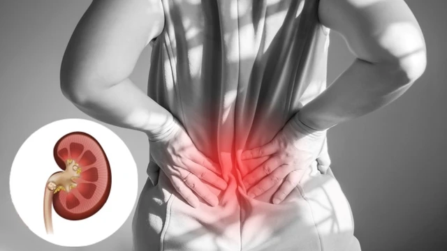 bai-viet/nhan-biet-cac-trieu-chung-soi-tiet-nieu.html