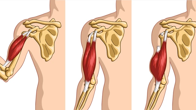 benh/viem-gan-nhi-dau-vai.html
