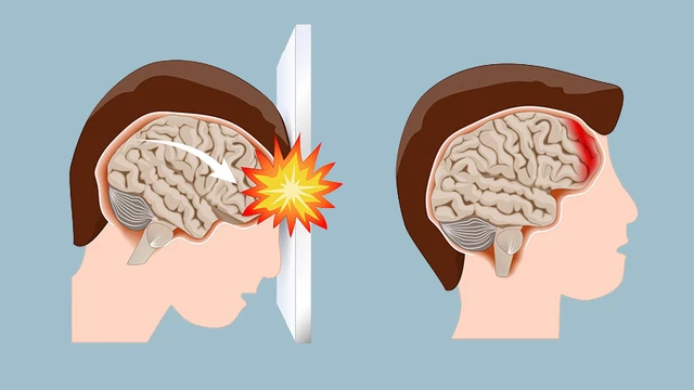 bai-viet/vi-tri-xuat-huyet-nao-nguy-hiem-nhat-o-dau-va-cach-dieu-tri.html