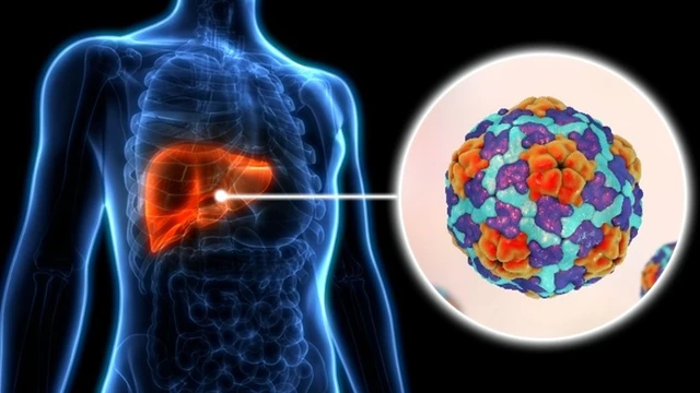 bai-viet/viem-gan-a-co-chua-duoc-khong-bien-chung-va-cach-phong-ngua-benh-viem-gan-a.html