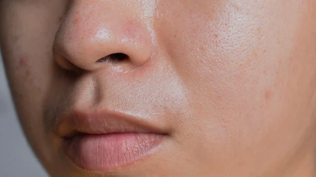 bai-viet/aha-bha-pha-la-gi-cong-dung-doi-voi-lan-da-va-cach-su-dung.html