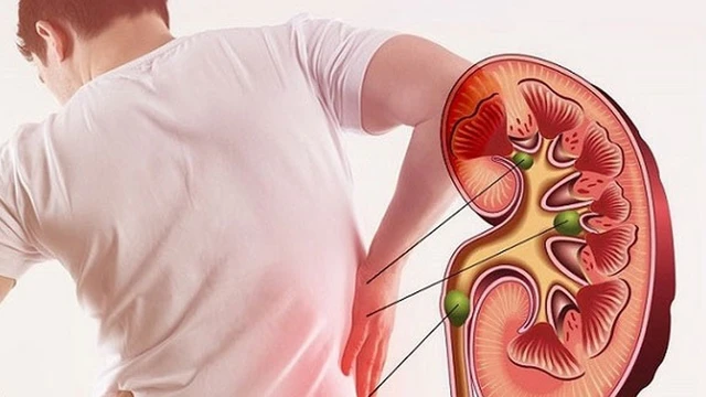 bai-viet/an-gi-de-dao-thai-soi-than-71245.html