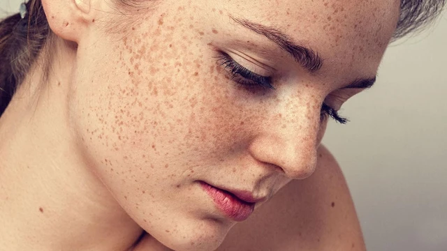 bai-viet/an-gi-de-giam-sac-to-da-melanin-50799.html