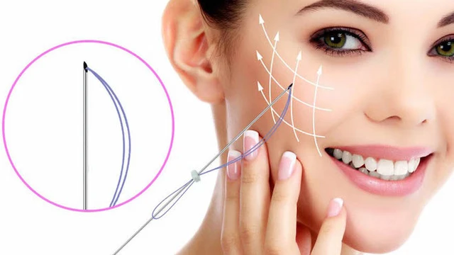 bai-viet/cang-chi-collagen-co-tot-khong-phuong-phap-cang-chi-collagen-co-uu-diem-gi.html