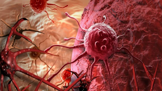 bai-viet/tong-hop-cac-bai-thuoc-chua-u-mau-trong-gan.html