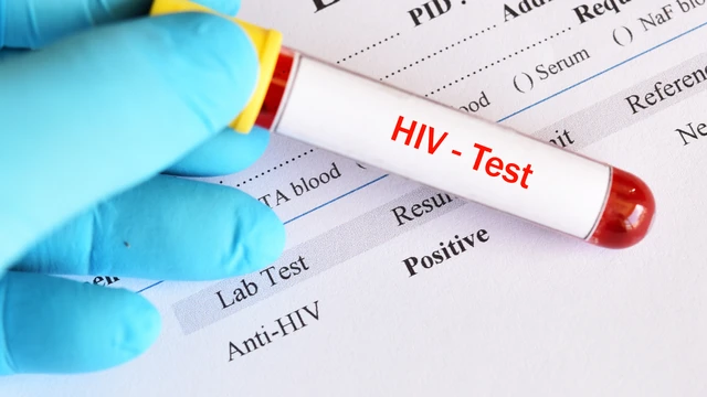 bai-viet/xet-nghiem-hiv-ag-ab-mien-dich-tu-dong-nhung-dieu-can-biet.html