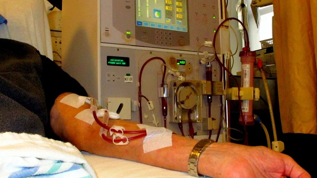 bai-viet/benh-nhan-chay-than-giai-doan-cuoi-song-duoc-bao-lau.html