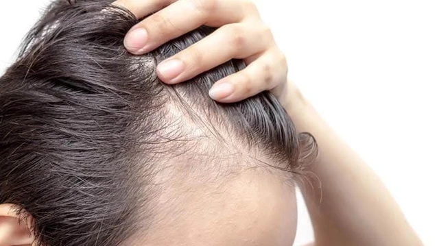 bai-viet/bi-quyet-phuc-hoi-nang-toc-tu-nhien-an-toan-va-don-gian.html