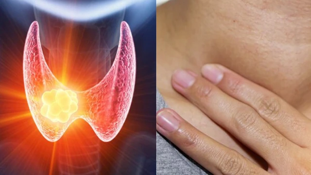 bai-viet/trieu-chung-u-tuyen-giap-ban-khong-nen-chu-quan-va-phuong-phap-dieu-tri.html