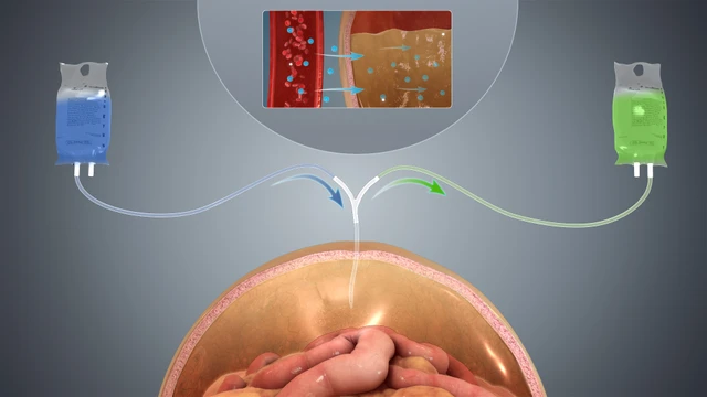 bai-viet/chay-than-co-dau-khong-tac-dung-phu-va-cac-bien-chung-co-the-gap-khi-chay-than.html