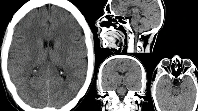 bai-viet/chup-ct-so-nao-duoc-thuc-hien-khi-nao-co-anh-huong-gi-khong.html