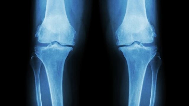 bai-viet/gay-sun-tang-truong-o-tre-em-nguyen-nhan-trieu-chung-chan-doan-dieu-tri.html