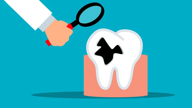 bai-viet/hoai-tu-tuy-rang-co-nguy-hiem-khong-dieu-tri-va-phong-ngua-ra-sao.html