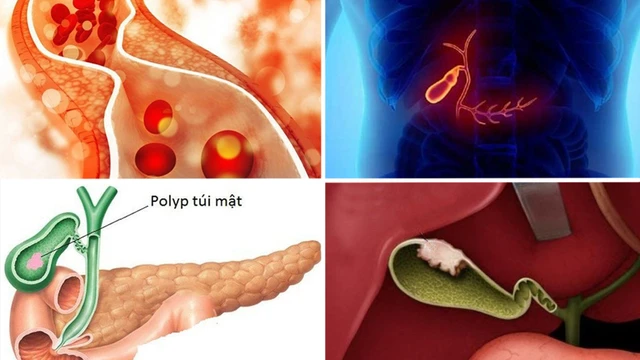 bai-viet/u-tui-mat-lanh-tinh-do-nguyen-nhan-gi-trieu-chung-va-cach-dieu-tri-hieu-qua.html