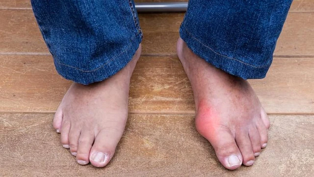 bai-viet/phu-tay-chan-do-nguyen-nhan-gi-khi-nao-can-di-kham-bac-si.html