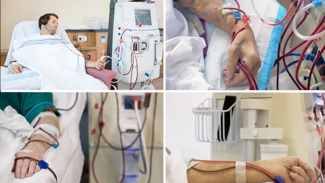 bai-viet/quy-trinh-cham-soc-benh-nhan-chay-than-nhan-tao-tai-nha-va-nhung-dieu-can-luu-y.html