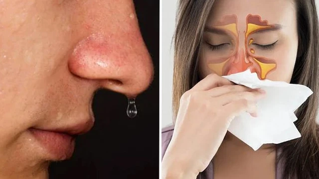 bai-viet/ro-dich-nao-tuy-la-gi-co-nguy-hiem-khong.html