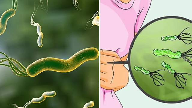 bai-viet/dieu-tri-vi-khuan-hp-khang-thuoc-the-nao-cho-dung.html