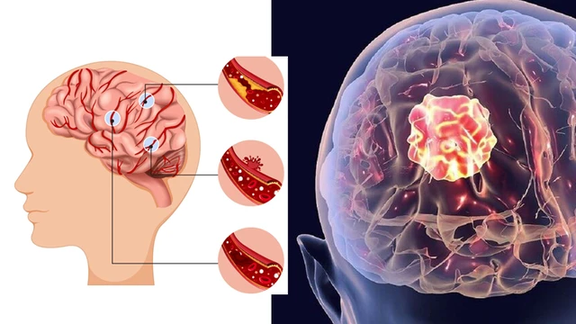 bai-viet/xuat-huyet-noi-so-la-gi-co-nguy-hiem-khong.html