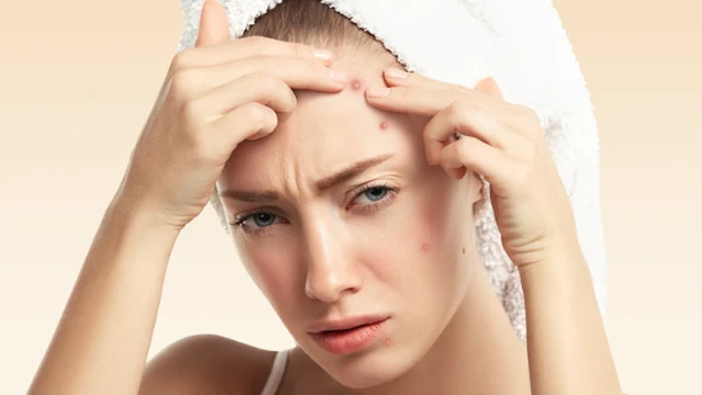 bai-viet/ban-da-biet-cach-nan-mun-boc-bi-chai-cung-duoi-da-chinh-xac-chua-67013.html