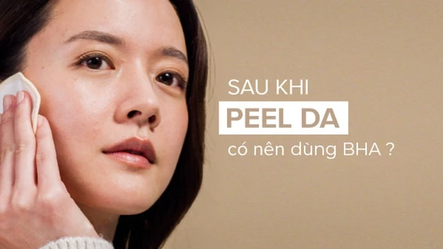 bai-viet/ban-da-biet-sau-khi-peel-da-co-nen-dung-bha-khong-hay-chua.html