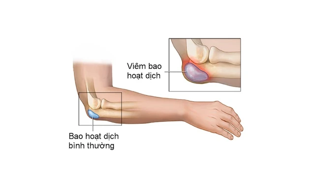 bai-viet/bao-hoat-dich-la-gi-chuc-nang-cua-bao-hoat-dich.html