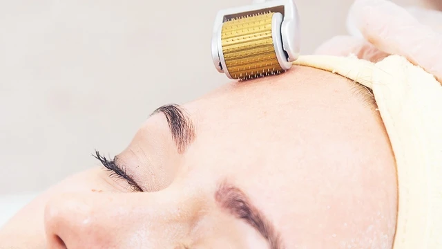 bai-viet/bao-lau-lan-kim-1-lan-lan-kim-nhieu-lan-co-tot-khong.html