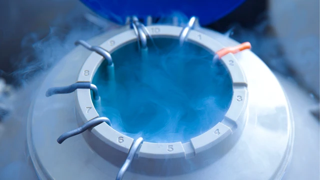 Bao nhiêu tuổi thì nên trữ đông trứng? Ảnh hưởng của độ tuổi đến chất lượng trứng