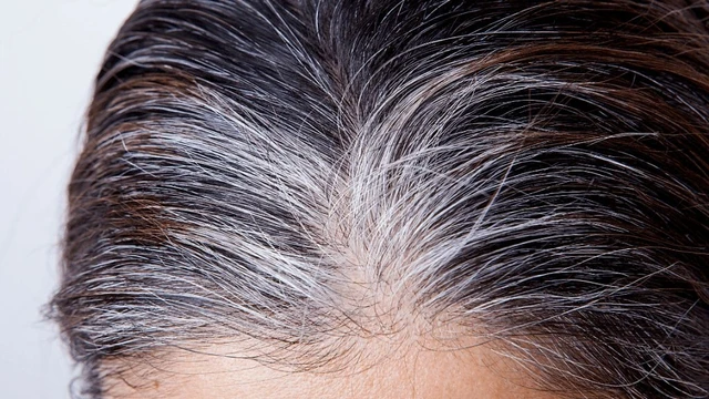 bai-viet/bat-mi-cac-cach-khac-phuc-tinh-trang-toc-bac-som.html