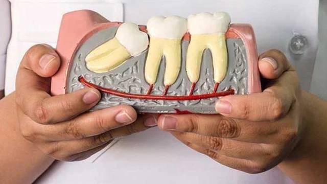 bai-viet/bat-mi-mot-so-phuong-phap-chinh-rang-moc-lech-khong-can-nieng.html