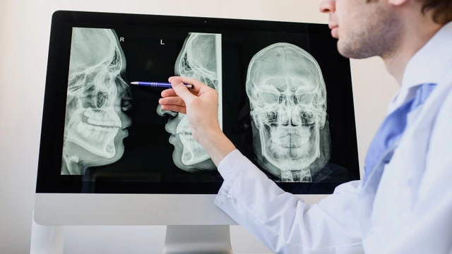 bai-viet/bat-san-xuong-mui-nguyen-nhan-trieu-chung-va-cach-dieu-tri-hieu-qua.html