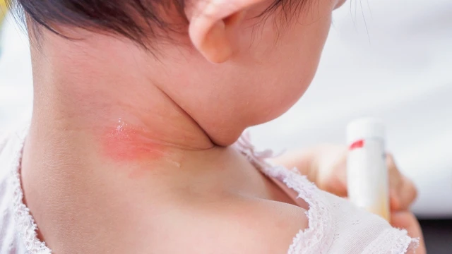 bai-viet/be-bi-ham-co-dau-hieu-nhan-biet-va-cach-de-cham-soc-59690.html