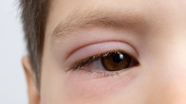 bai-viet/be-bi-sung-mat-nguyen-nhan-va-nhung-dieu-cha-me-can-biet.html