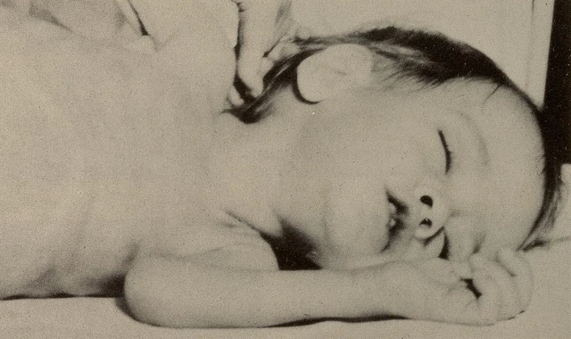 bai-viet/benh-niemann-pick-nguyen-nhan-trieu-chung-va-huong-dieu-tri.html