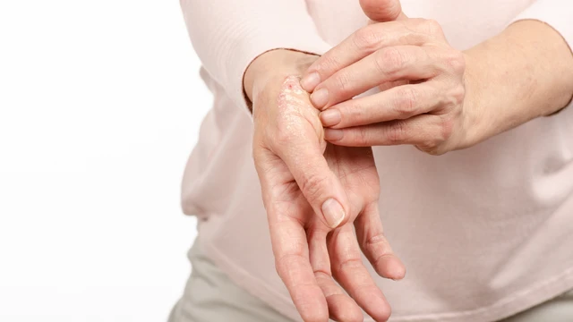 benh/a-sung-512.html