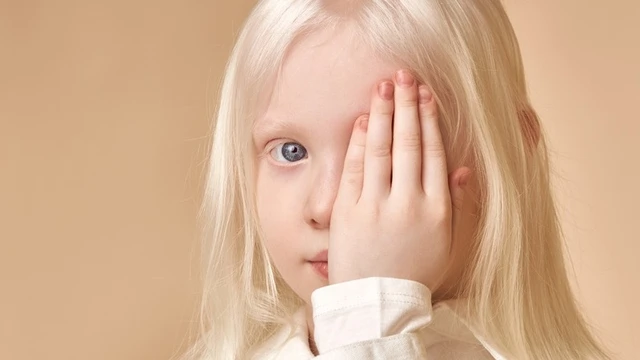 bai-viet/benh-bach-tang-song-duoc-bao-lau-nguyen-nhan-dan-den-benh-bach-tang-68763.html