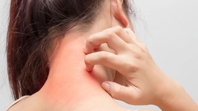 bai-viet/benh-di-ung-kim-loai-do-deo-trang-suc-va-cach-khac-phuc-40549.html