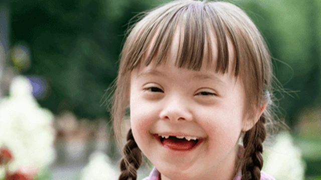 bai-viet/benh-down-co-di-truyen-khong-trieu-chung-va-dau-hieu-cua-hoi-chung-down.html