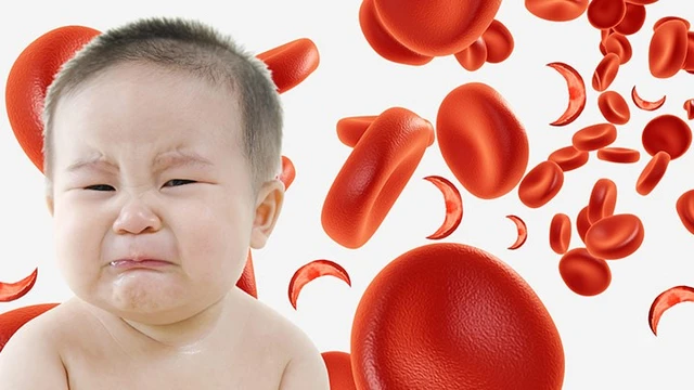 bai-viet/lam-va-sao-de-khac-phuc-skinny-fat-70633.html