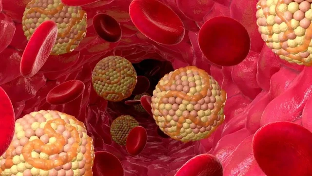 bai-viet/benh-mo-mau-cao-co-chua-khoi-duoc-khong-va-nhung-dieu-can-biet.html