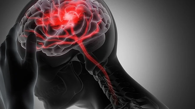 bai-viet/benh-nhoi-mau-nao-co-nguy-hiem-khong.html