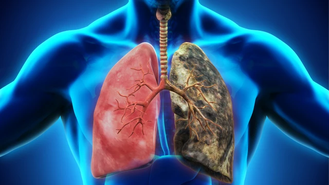 bai-viet/benh-phoi-cac-loai-benh-thuong-gap-va-trieu-chung-can-luu-y.html