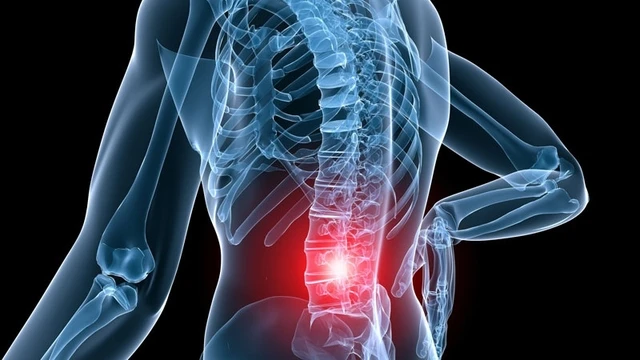 bai-viet/benh-re-than-kinh-that-lung-nguyen-nhan-trieu-chung-va-cach-khac-phuc.html