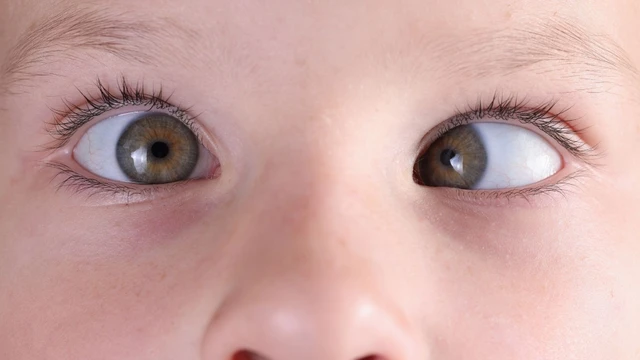 bai-viet/benh-rung-giat-nhan-cau-bam-sinh-la-gi-57746.html