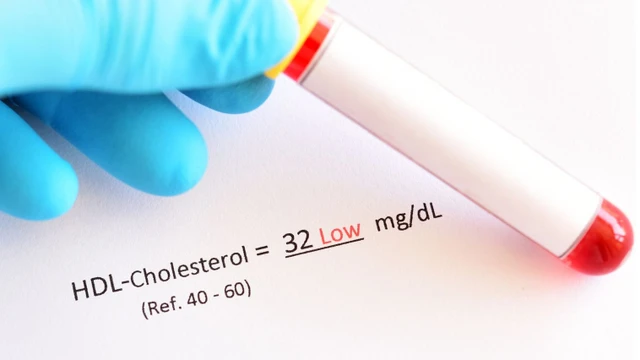 bai-viet/benh-tangier-can-benh-hiem-gap-nhung-nguy-hiem-khong-ngo.html