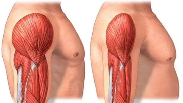 bai-viet/benh-teo-co-delta-dau-hieu-nguyen-nhan-va-giai-phap-can-thiep.html