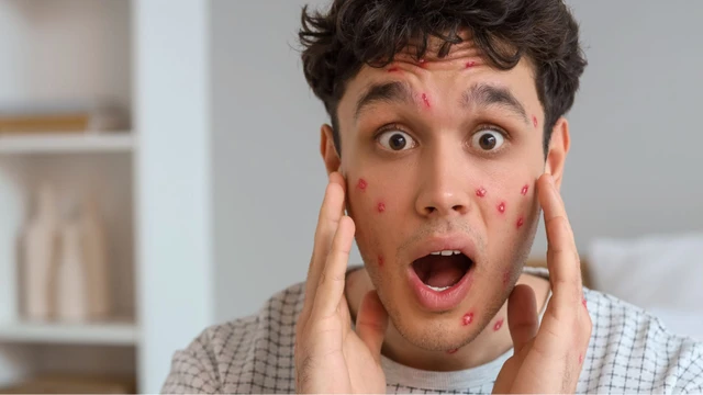 bai-viet/benh-thuy-dau-co-nguy-hiem-khong-bien-phap-dieu-tri-va-phong-ngua.html