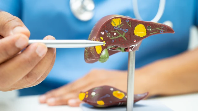 bai-viet/benh-viem-gan-b-co-gay-xo-gan-khong.html