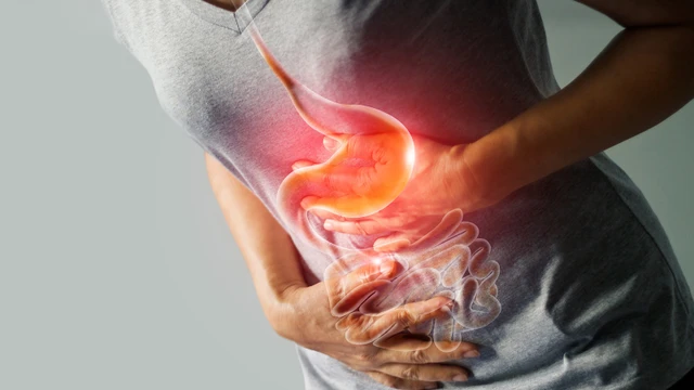 bai-viet/benh-viem-teo-da-day-co-nguy-hiem-khong-can-nguyen-va-phuong-phap-dieu-tri-benh.html